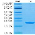 Human IL-1 Beta/IL-1F2 Protein (IL1-HE40B)
