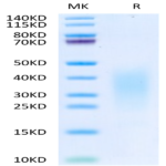 Human IL-13 Protein (IL1-HM013)