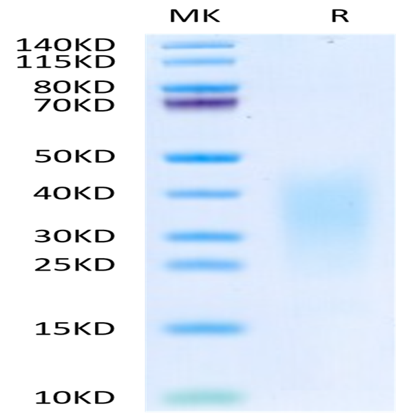 Human IL-13 Protein (IL1-HM013)