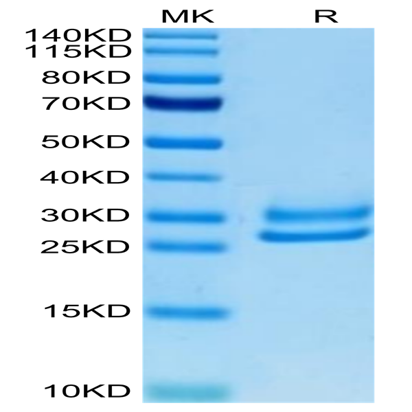 Human IL-15RA&IL-15 Protein (IL1-HM1R5)