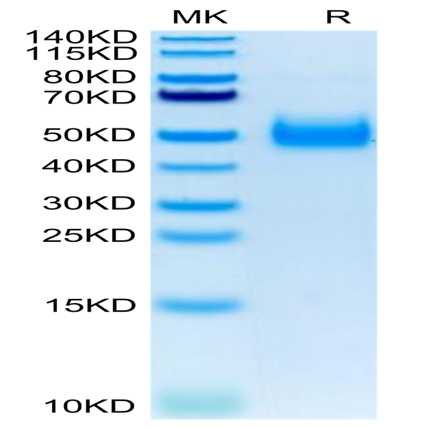 Human IL-17RB Protein (IL1-HM1RB)