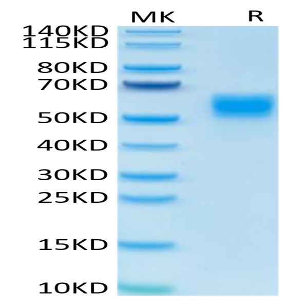 Human IL-13 Protein (IL1-HM213)