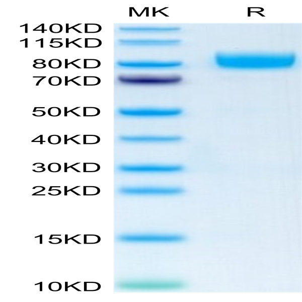 Human IL-1 Rrp2/IL-1 R6 Protein (IL1-HM2L2)