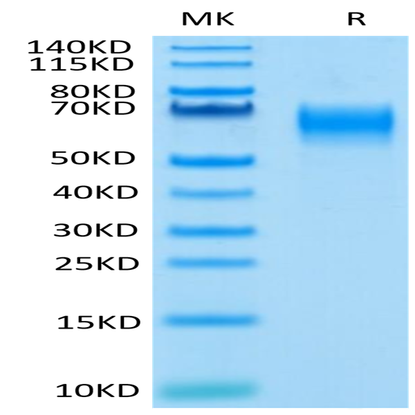 Human IL-1 Rrp2/IL-1 R6 Protein (IL1-HM4L2)