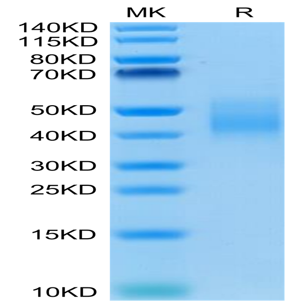 Human IL-10 R alpha Protein (IL1-HM4RA)