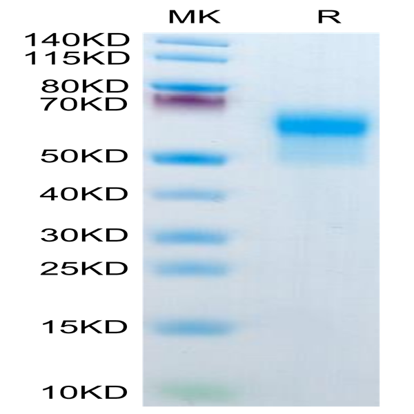 Mouse IL-1R2/IL-1 RII/CD121b Protein (IL1-MM1R2)