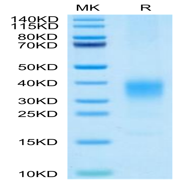 Cynomolgus IL-22 Protein (IL2-CM122)