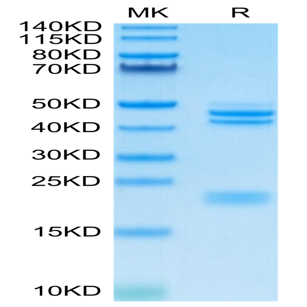 Cynomolgus IL-23 alpha&Mouse IL-12 beta Protein (IL2-CM1AB)