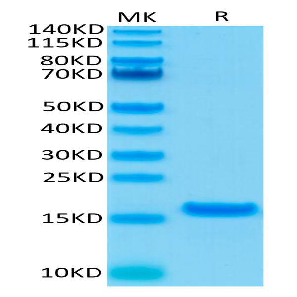 Human IL-21 Protein (IL2-HE021)
