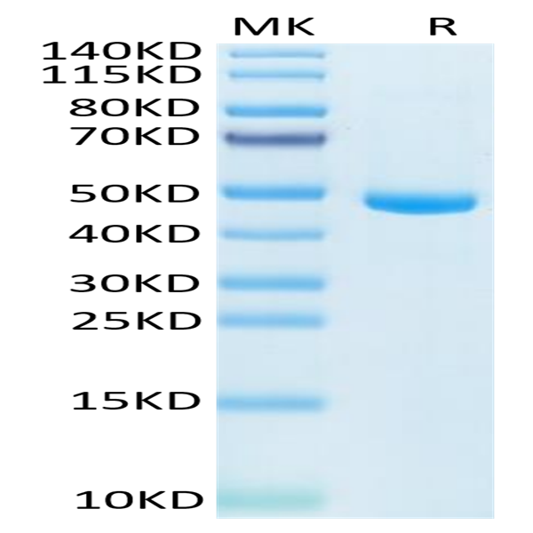 Human IL-20 Protein (IL2-HM120)