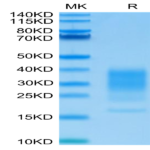 Human IL-22 Protein (IL2-HM122)