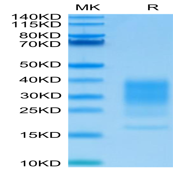 Human IL-22 Protein (IL2-HM122)