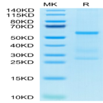 Human IL-27 Protein (IL2-HM127)