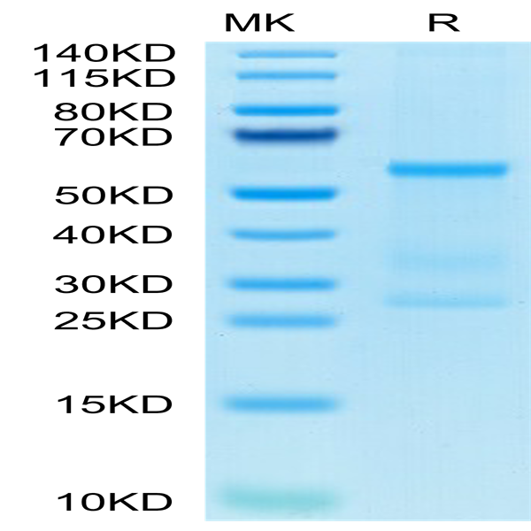 Human IL-27 Protein (IL2-HM127)
