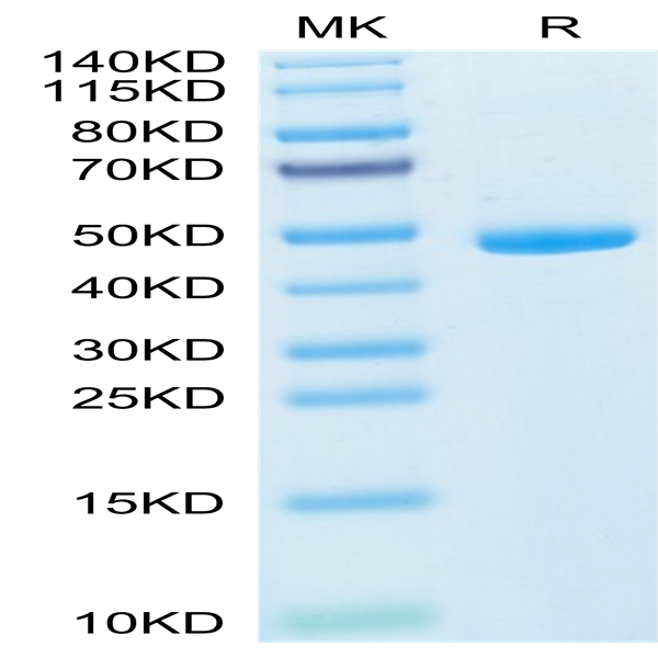 Mouse IL-20 Protein (IL2-MM120)