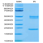 Mouse IL-23 alpha&IL-12 beta Protein (IL2-MM1AB)