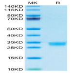 Mouse IL-2 Protein (IL2-MM401)