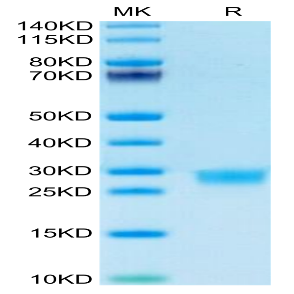 Mouse IL-2 Protein (IL2-MM401)
