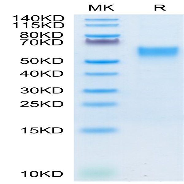 Cynomolgus IL-3 R alpha/CD123 Protein (IL3-CM1RA)