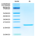 Human IL-3 Protein (IL3-HE401)