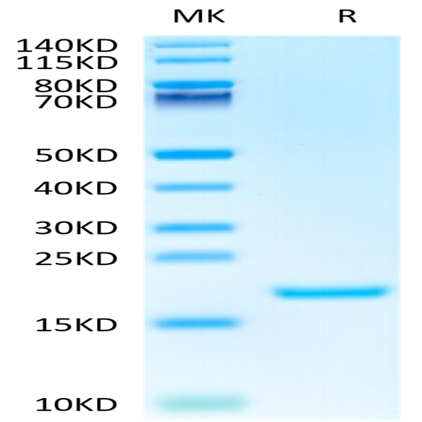 Human IL-3 Protein (IL3-HE401)