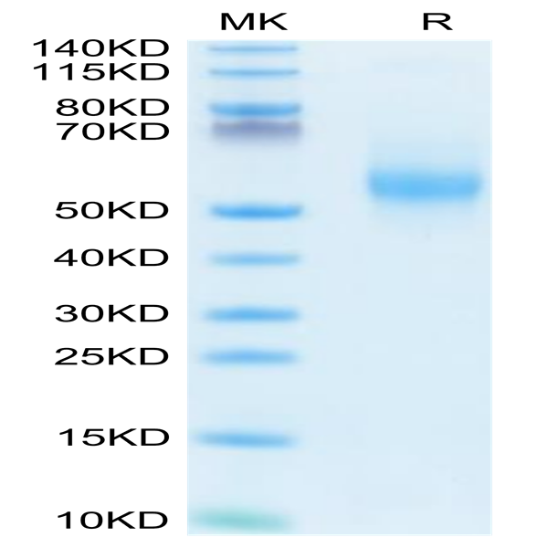 Human IL-3 Protein (IL3-HM201)