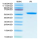 Human IL-17B Protein (IL7-HM27B)