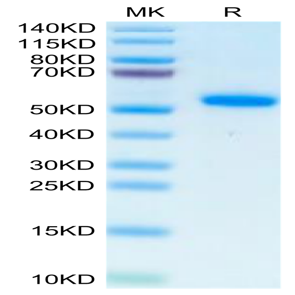Human IL-17B Protein (IL7-HM27B)