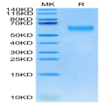 Cynomolgus IL-18RAP Protein (IL8-CM1AP)