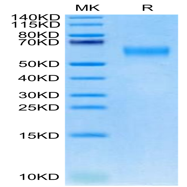 Cynomolgus IL-18RAP Protein (IL8-CM1AP)