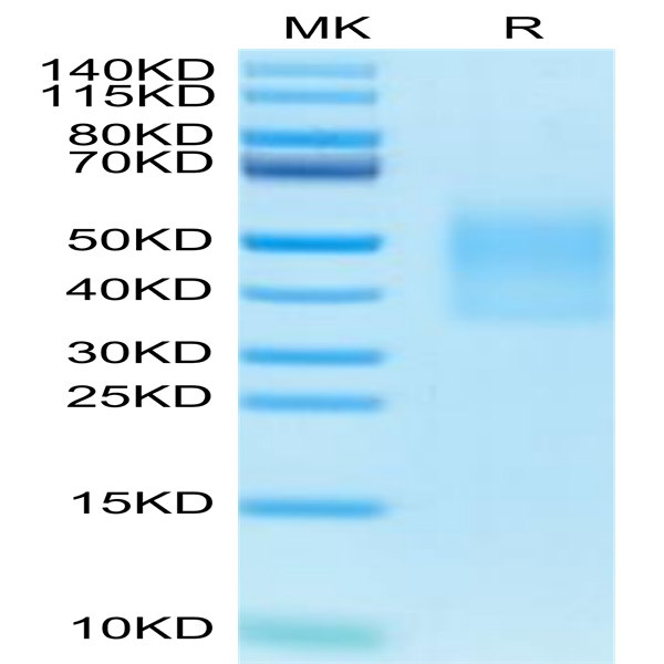 Cynomolgus IL-18BP Protein (IL8-CM1BP)