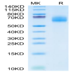 Cynomolgus IL-18 R1/CD218a Protein (IL8-CM1R1)