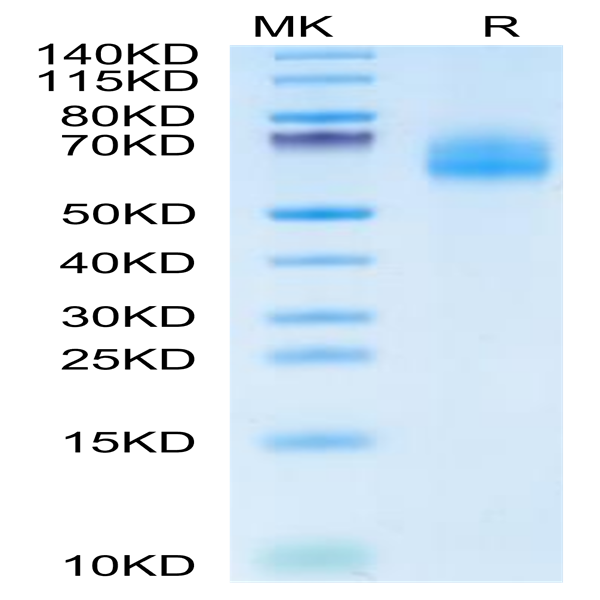Cynomolgus IL-18 R1/CD218a Protein (IL8-CM1R1)