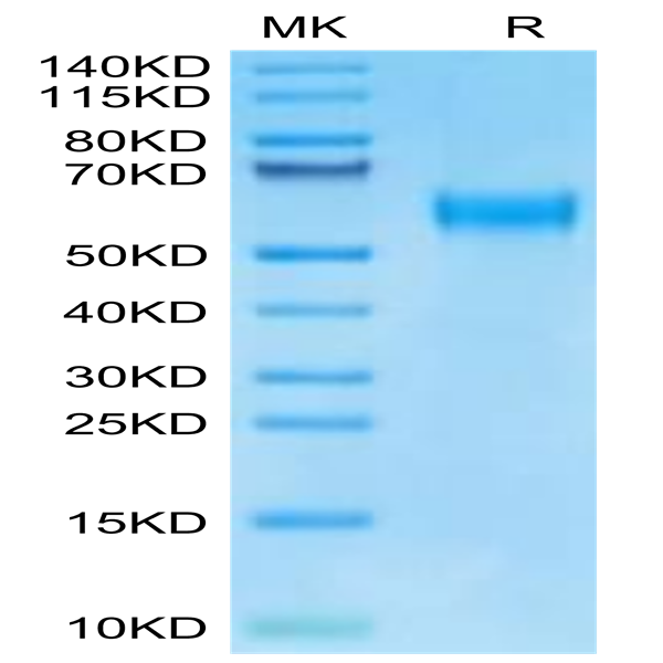Human IL-18RAP Protein (IL8-HM1AP)