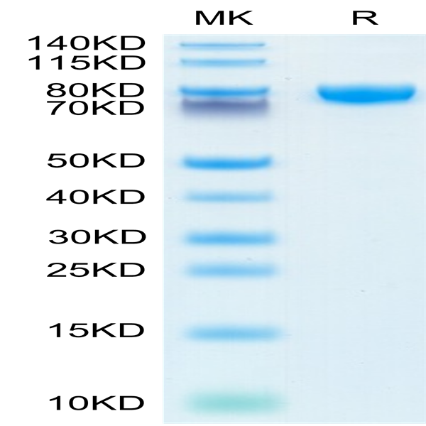 Human IL-18RAP Protein (IL8-HM2AP)