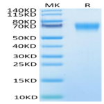 Human IL-18BP Protein (IL8-HM2BP)