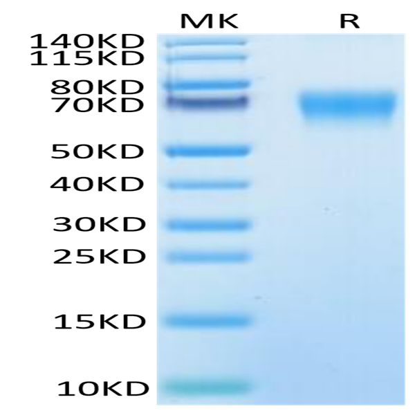 Human IL-18BP Protein (IL8-HM2BP)