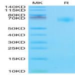 Mouse IL-18BP Protein (IL8-MM2BP)