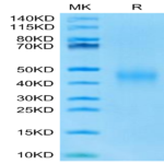 Mouse IL-9 Protein (IL9-MM101)