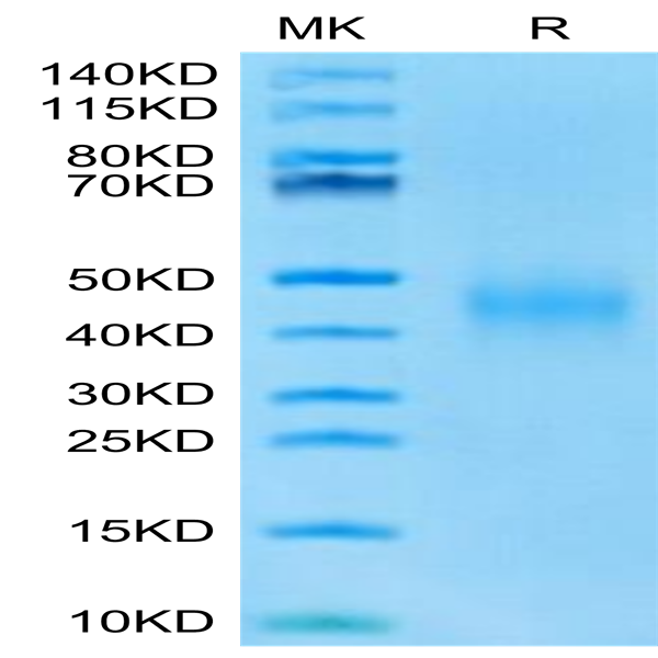 Mouse IL-9 Protein (IL9-MM101)