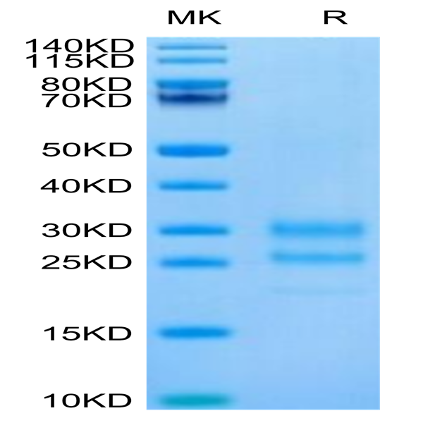 Cynomolgus IL-17A/CTLA-8 Protein (ILA-CM417)