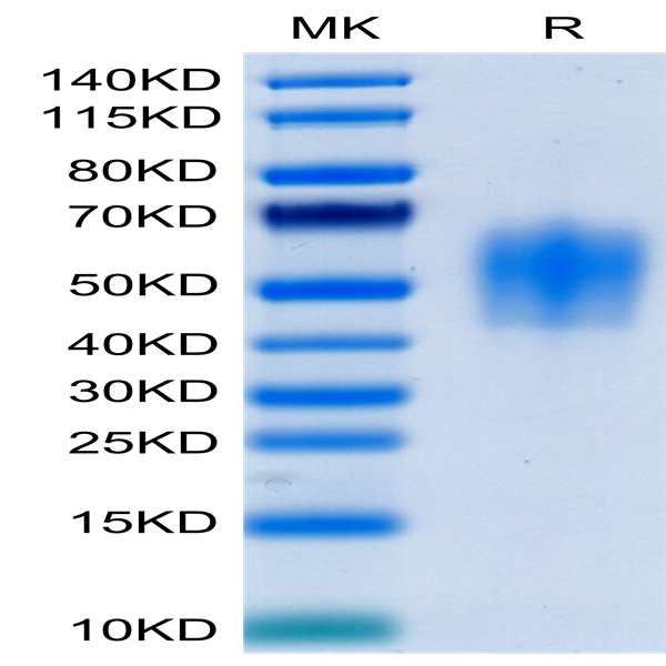 Human IL-4 R alpha/CD124 Protein (ILA-HM14R)