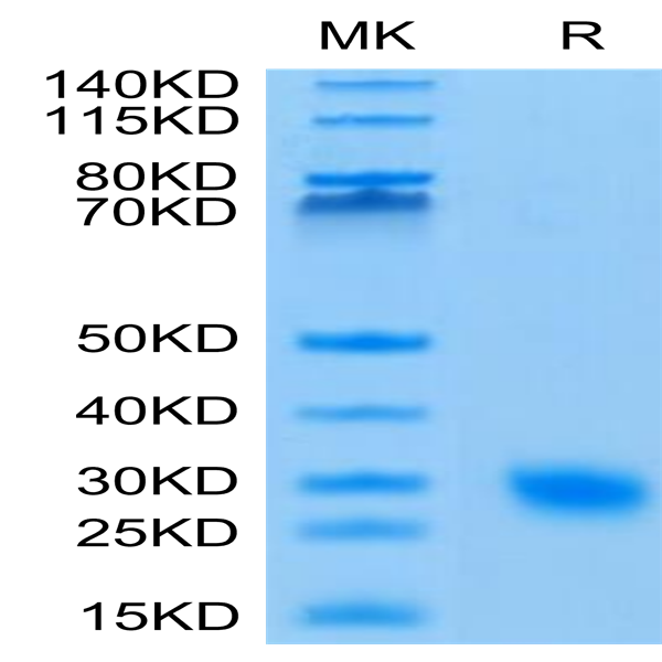 Human IL-17F Protein (ILF-HM119)