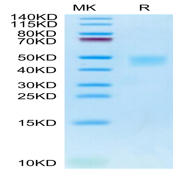 Cynomolgus IL-21R Protein (ILR-CM121)