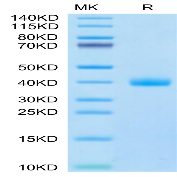 Cynomolgus IL-22R alpha 1 Protein (ILR-CM122)