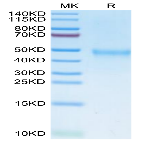 Human IL-21R Protein (ILR-HM121)