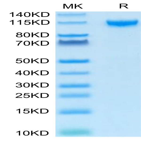 Human IL-27RA/TCCR Protein (ILR-HM127)