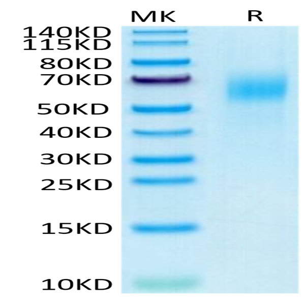 Human IL-13Ra1 Protein (ILR-HM1R1)