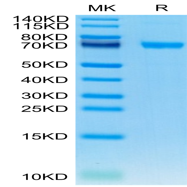 Human IL-21R Protein (ILR-HM221)