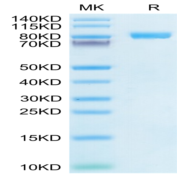 Human IL-6 R alpha/CD126 Protein (ILR-HM26R)